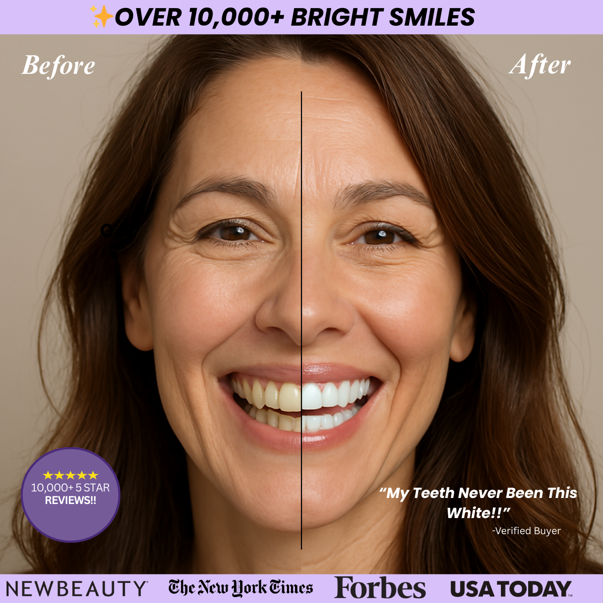 Luminous Lavender™ Teeth Whitening